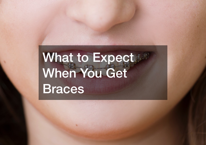 What to Expect When You Get Braces