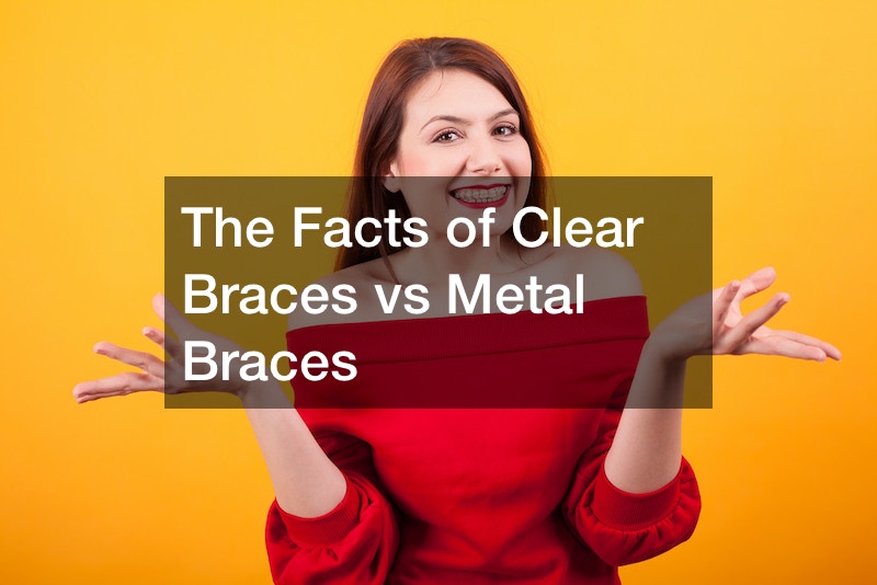The Facts of Clear Braces vs Metal Braces