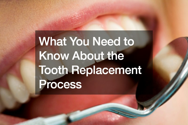 What You Need to Know About the Tooth Replacement Process