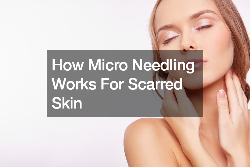 How Micro Needling Works For Scarred Skin